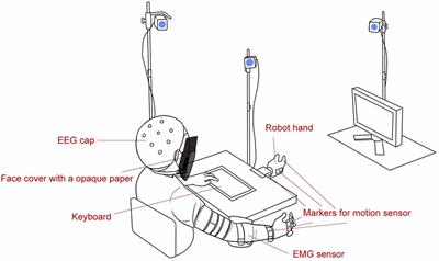 Brain Activity Reflects Subjective Response to Delayed Input When Using an Electromyography-Controlled Robot